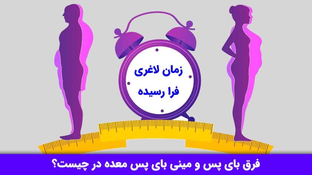 فرق بای پس و مینی بای پس معده