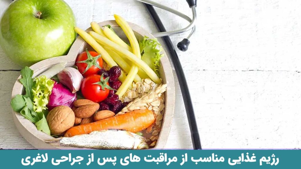 رژیم غذایی مناسب از مراقبت های پس از جراحی لاغری