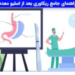 ریکاوری بعد از اسلیو معده