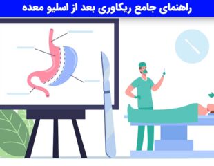 ریکاوری بعد از اسلیو معده