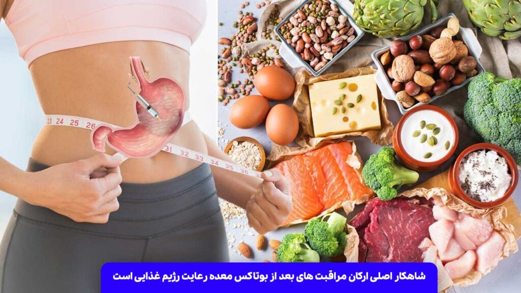 شاهکار اصلی ارکان مراقبت های بعد از بوتاکس معده رعایت رژیم غذایی است