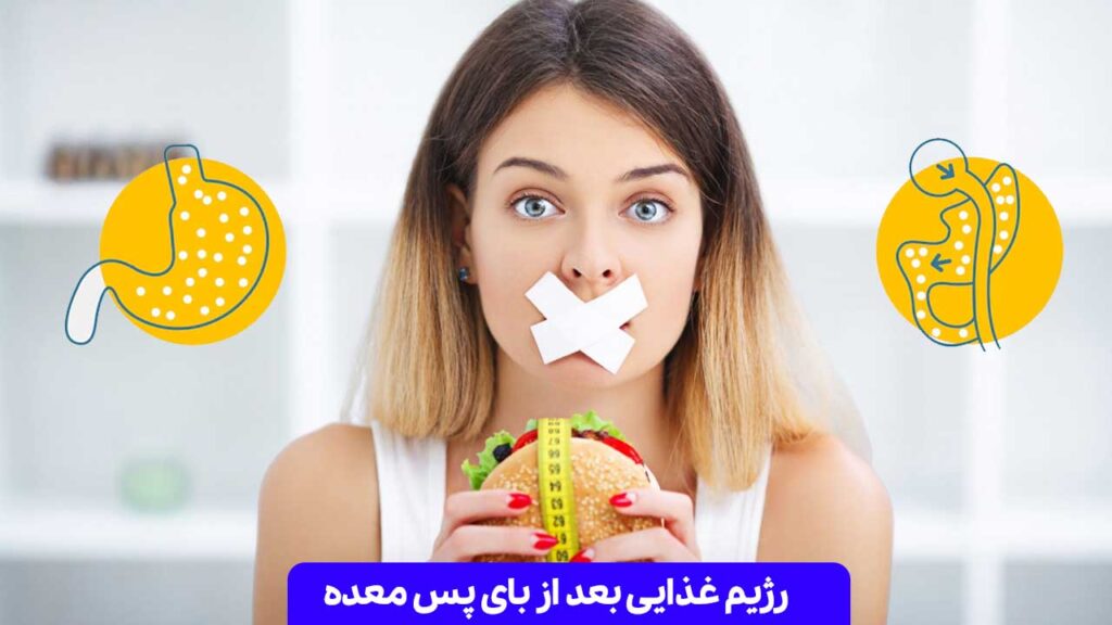 رژیم غذایی بعد از بای پس معده