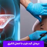 درمان کبد چرب با عمل لاغری