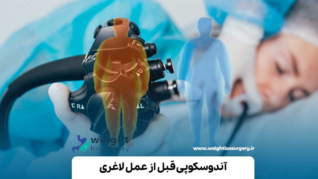 آندوسکوپی قبل از عمل لاغری