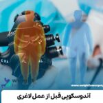 آندوسکوپی قبل از عمل لاغری