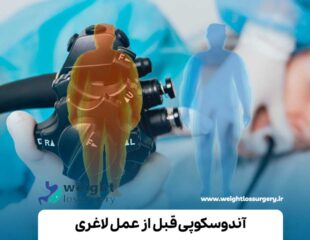 آندوسکوپی قبل از عمل لاغری