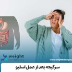 سرگیجه بعد از عمل اسلیو