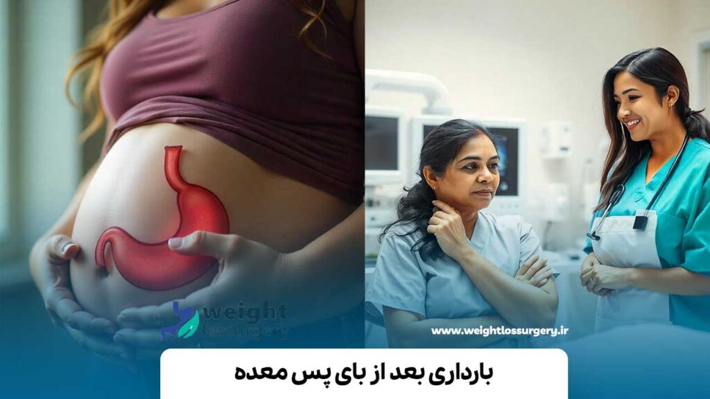 بارداری بعد از بای پس معده