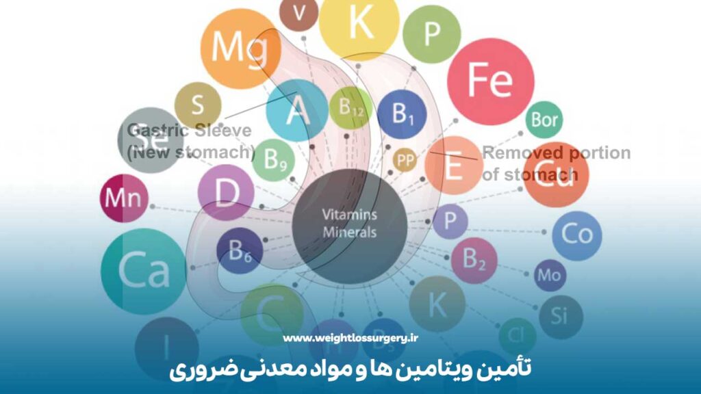 تأمین ویتامین ها و مواد معدنی ضروری بعد از اسلیو معده