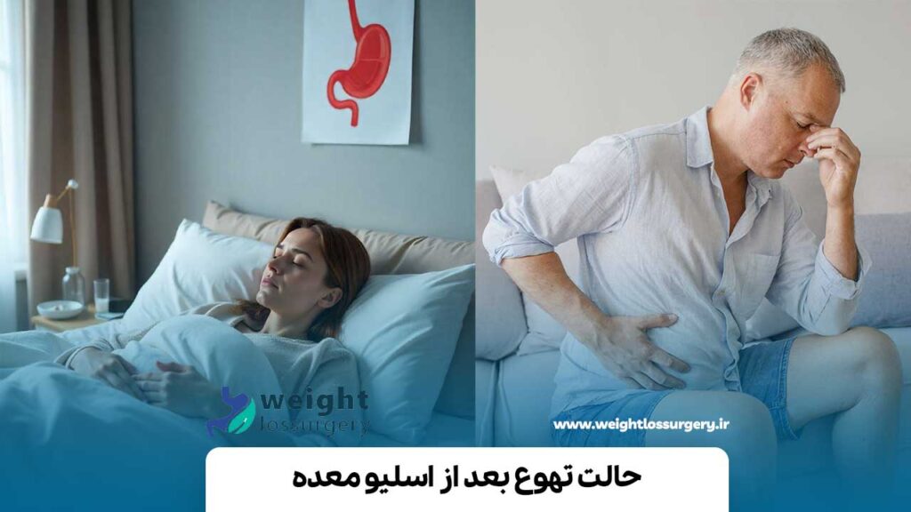 حالت تهوع بعد از اسلیو معده