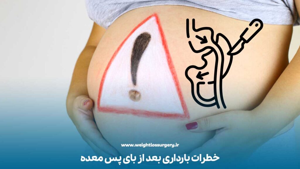 خطرات بارداری بعد از بای پس معده