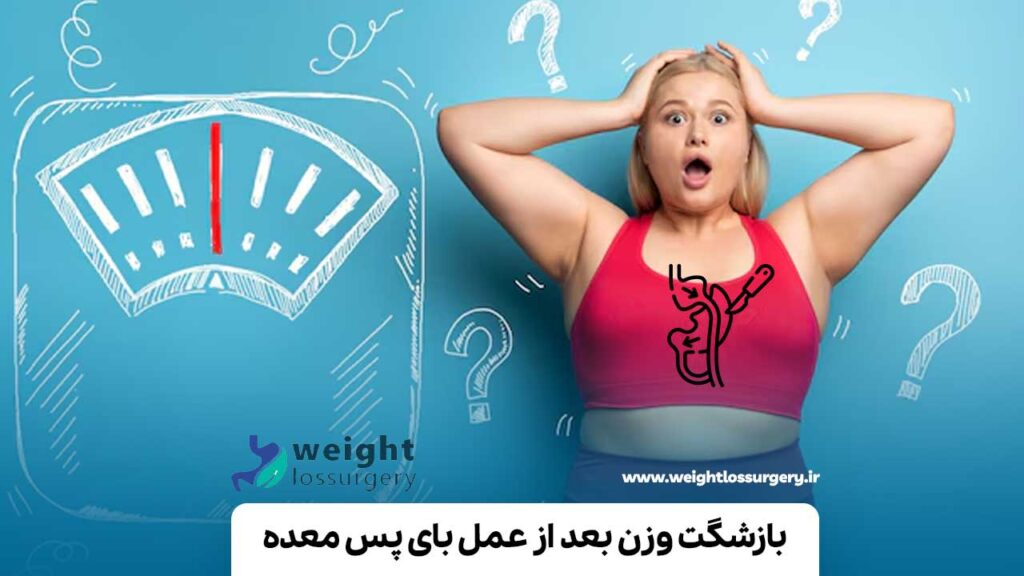 بازشگت وزن بعد از عمل بای پس معده