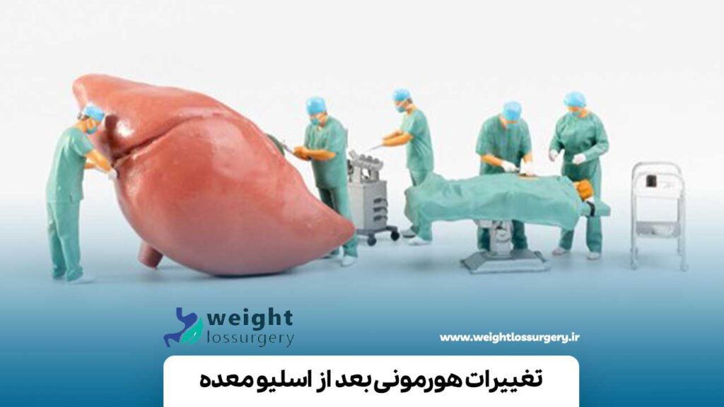 تغییرات هورمونی بعد از اسلیو معده