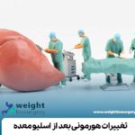 تغییرات هورمونی بعد از اسلیو معده