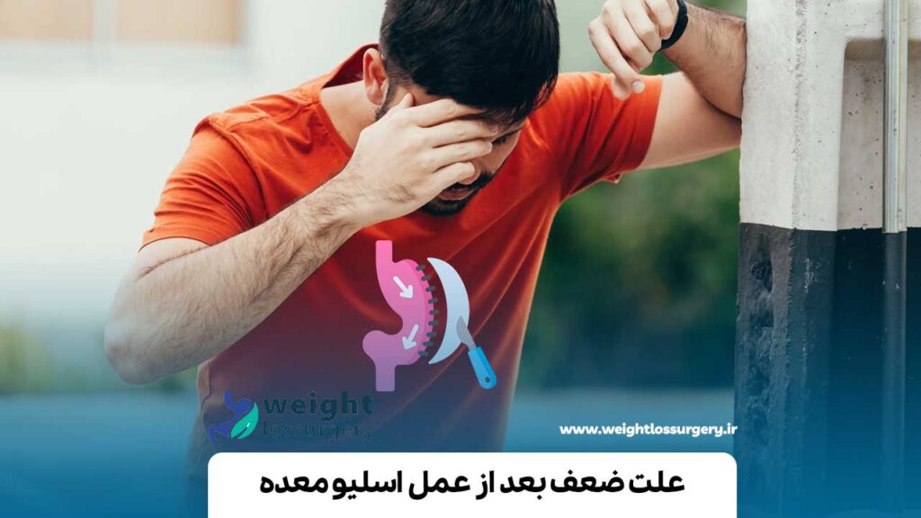 علت ضعف بعد از عمل اسلیو معده