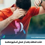 علت ضعف بعد از عمل اسلیو معده