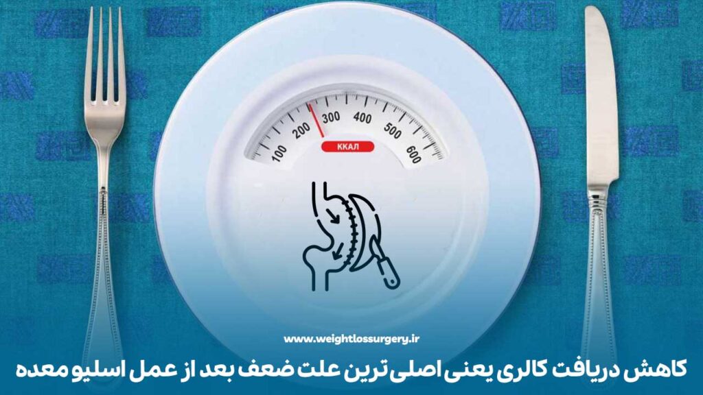 کاهش دریافت کالری یعنی اصلی ترین علت ضعف بعد از عمل اسلیو معده